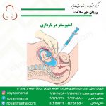 آمنتیوسنتز در بارداری