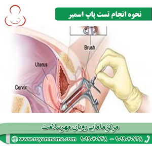 نحوه-انجام-تست-پاپ-اسمیر