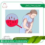 خونریزی بعد از زایمان