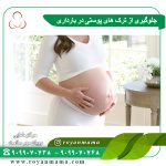 جلوگیری از ترک های پوستی در بارداری