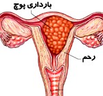 بارداری پوچ